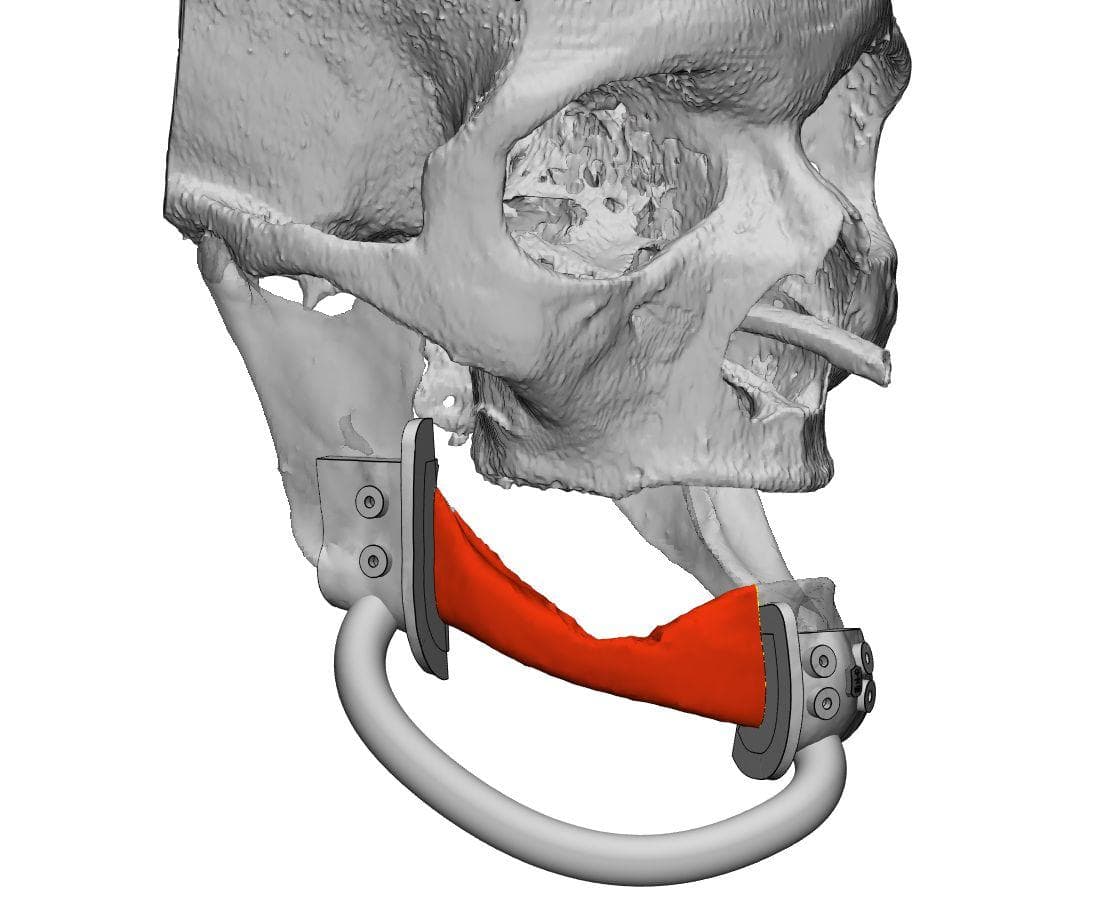 Pre-operative assessment