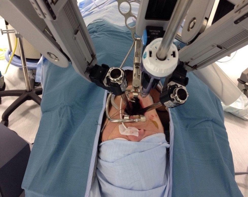 Surgical procedure